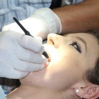 Zahnreinigung (3)