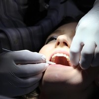 Zahnreinigung (4)