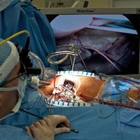 OP laparoskopisch (2)