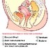 ENDOMETRIOSE Aufklärungskampagne im März 2019